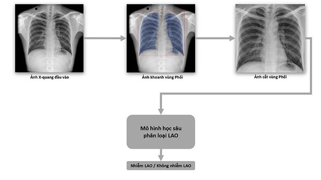 Sách trắng về ứng dụng AI tầm soát và phân loại bệnh lao